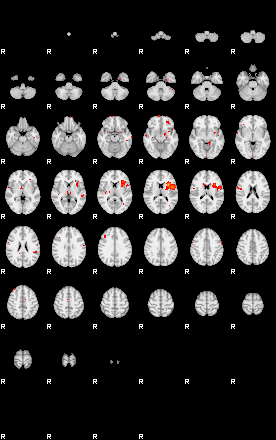 Patients 29112 59