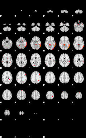 Patients 29153 9