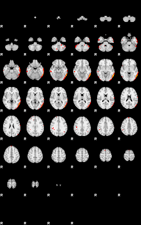 Patients 29173 9