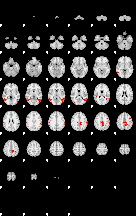 Patients 29174 190