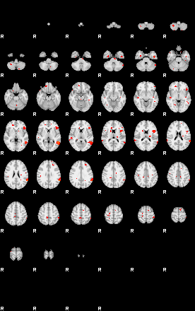 Patients 29177 123