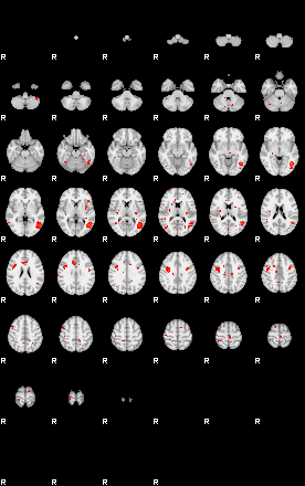 Patients 29181 190