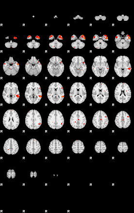 Patients 29189 167