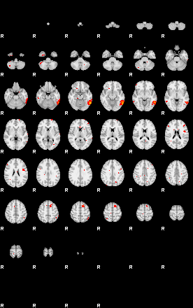 Patients 29206 10