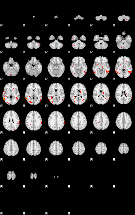 Patients 29281 136