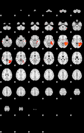 Patients 29413 194