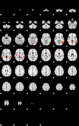 Patients 29575 134