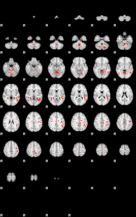 Patients 29591 87