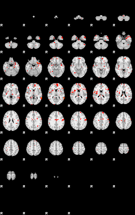 Patients 29610 14