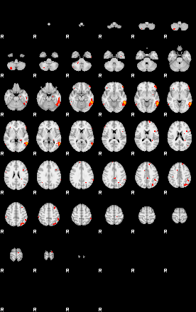 Patients 29675 11