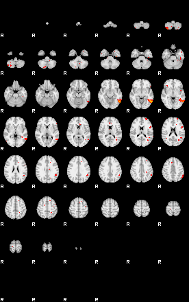 Patients 29879 8