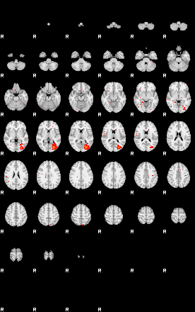 Patients 29516 127