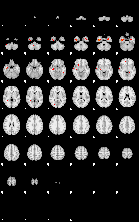 Patients 28718 3