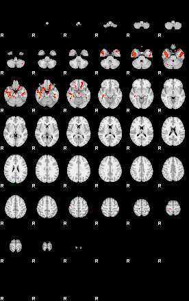 Patients 28909 3