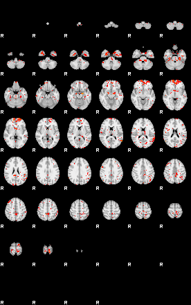 Patients 28933 199