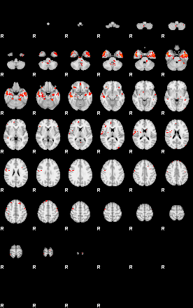 Patients 28964 169