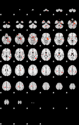 Patients 28966 200