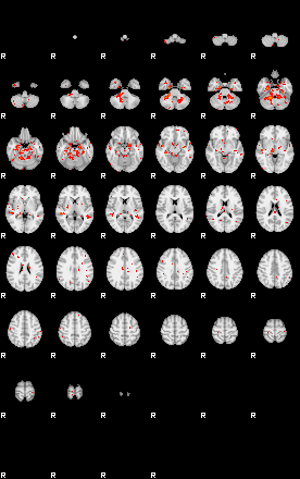 Patients 28966 95