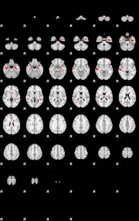 Patients 28972 5