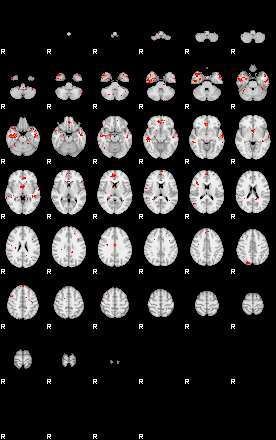 Patients 28997 4