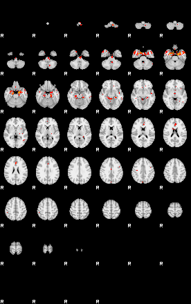 Patients 29006 4