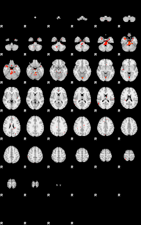 Patients 29006 42