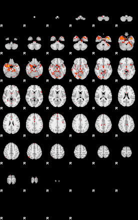 Patients 29013 112