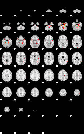 Patients 29025 13