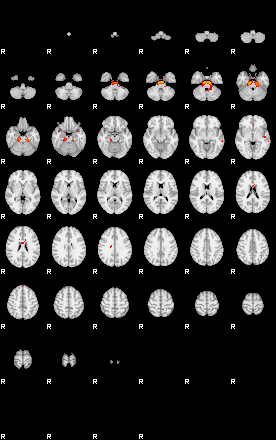 Patients 29096 14