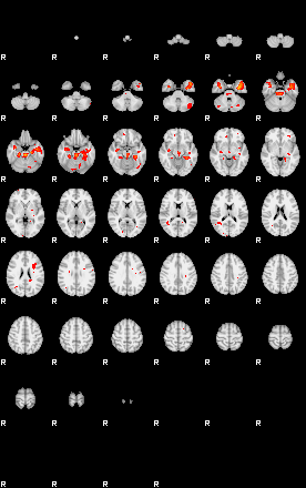 Patients 29100 97