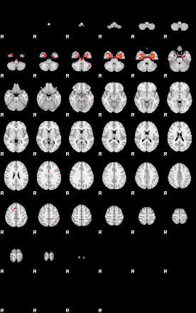 Patients 29103 105