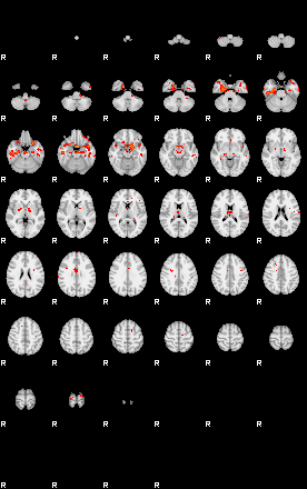 Patients 29106 169