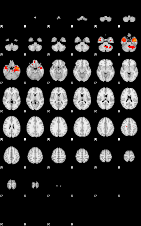 Patients 29110 29