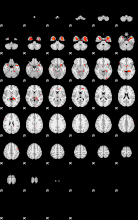 Patients 29113 103