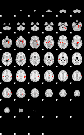 Patients 29152 164