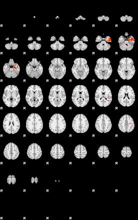 Patients 29152 30