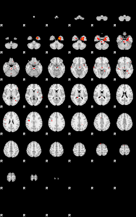 Patients 29155 151