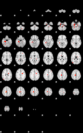 Patients 29162 13