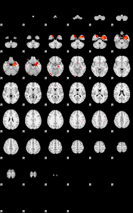 Patients 29169 78