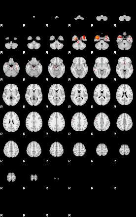 Patients 29173 176