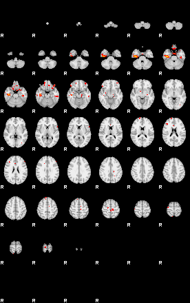 Patients 29174 6