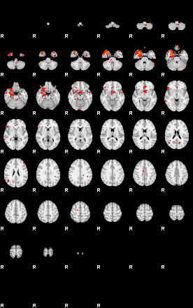 Patients 29181 118