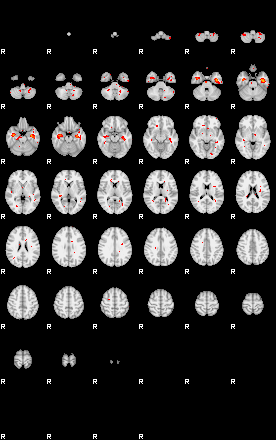 Patients 29181 4