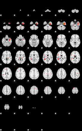 Patients 29182 169