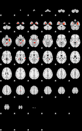 Patients 29191 113