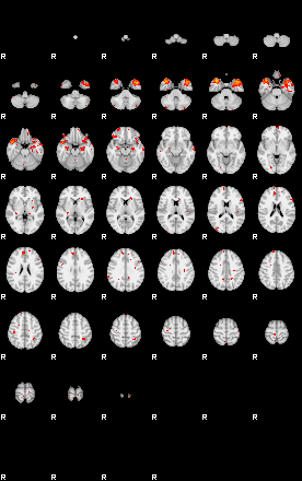 Patients 29191 115