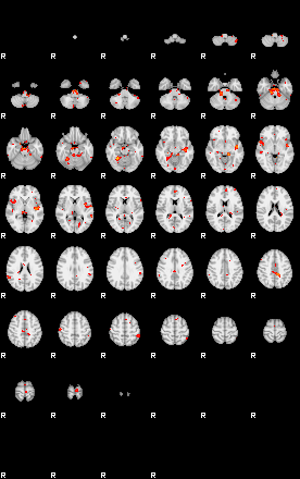 Patients 29191 168