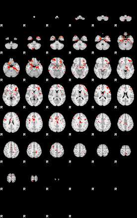 Patients 29191 31