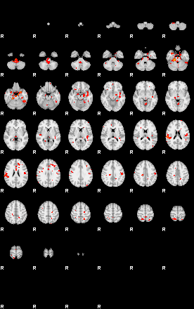 Patients 29206 59