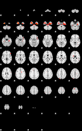 Patients 29207 109